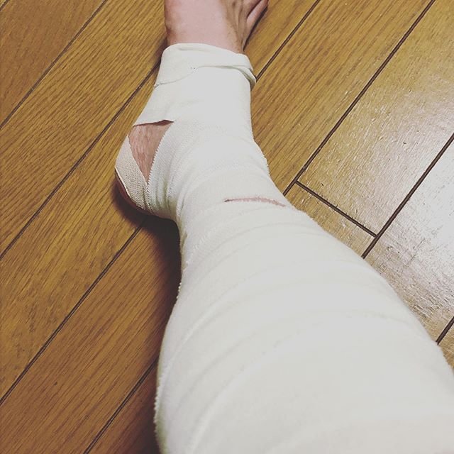 齋藤 翔悟 on Instagram: “やってしまいました。 仕事中に肉離れ。 あまり重たくない物を持ち上げた時に張ってしまいました。。 社内を移動するときは上司に車椅子ドライブされました。  スポーツは3週間ドクターストップです。  #肉離れ #pulledmuscle  #全治3週間…” (87243)